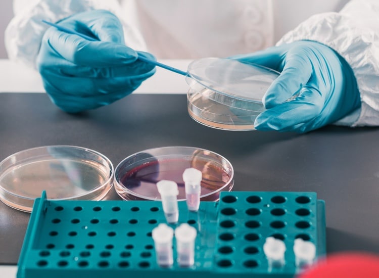 Bioburden testing services. Scientist working with a petri plaque in a laboratory facility