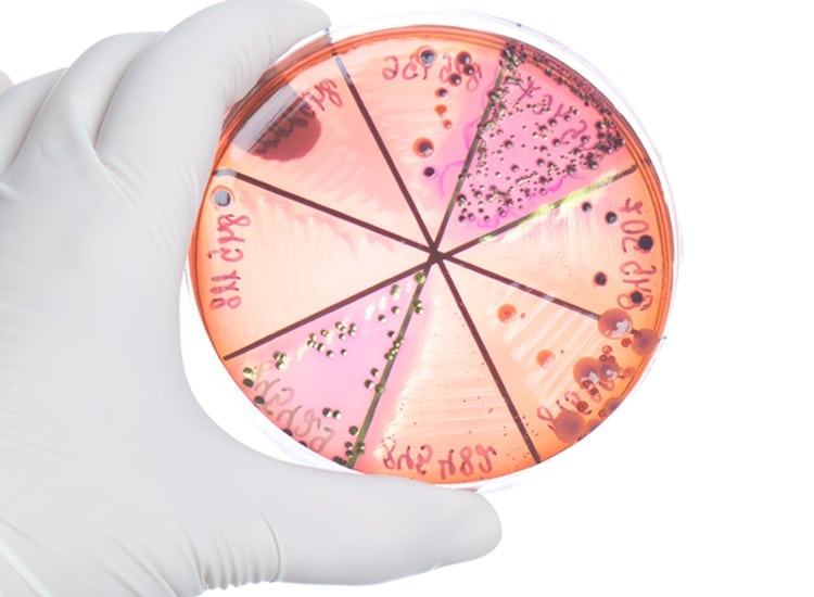 General microbiology testing services. Close picture of a hand holding a petri plaque with baterial colonies