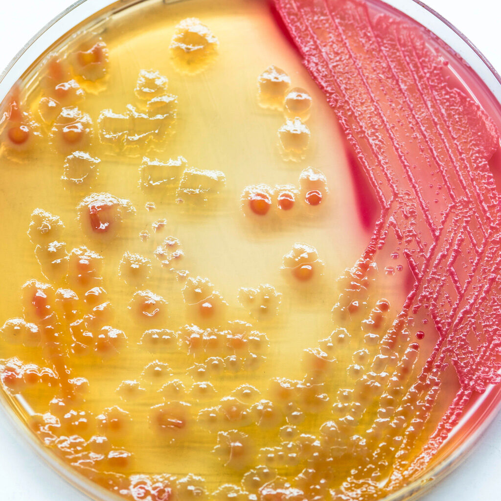 Close picture of a gram-positive bacteria in a petri plaque. Microbiology of air in manufacturing environments. Microbiology of air in regulatory environments. What is the microbiology of air. Microbiology of human skin. Why is knowing the microbiology of air important. Distribution of bacteria on skin sites