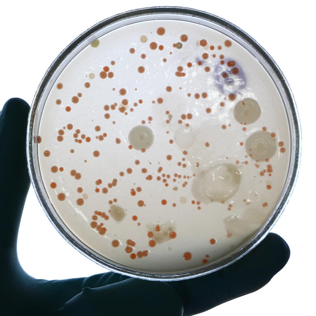 Close picture of laboratory technician’s hand holding a petri plaque. Preservative vs disinfectant challenge testing. What products require preservative challenge testing. What are disinfectants used for. Microbial contamination risk. Usp test methods. Reliable test methods