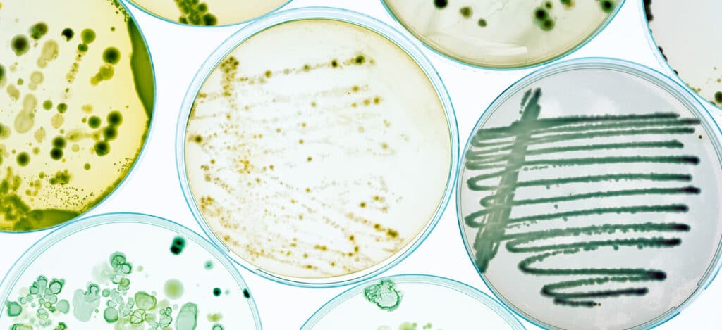 Picture of several petri plaques with green components inside. Preservative efficacy testing vs bioburden testing. Differences between preservative efficacy and bioburden testing. What products require preservative efficacy testing. What products require bioburden testing. Microbiology and bioburden testing methods